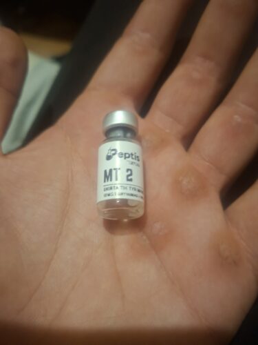 Melanotan II photo review